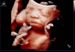 Unveiling Baby's Progress: The Key Highlights of the 20-Week Ultrasound Scan